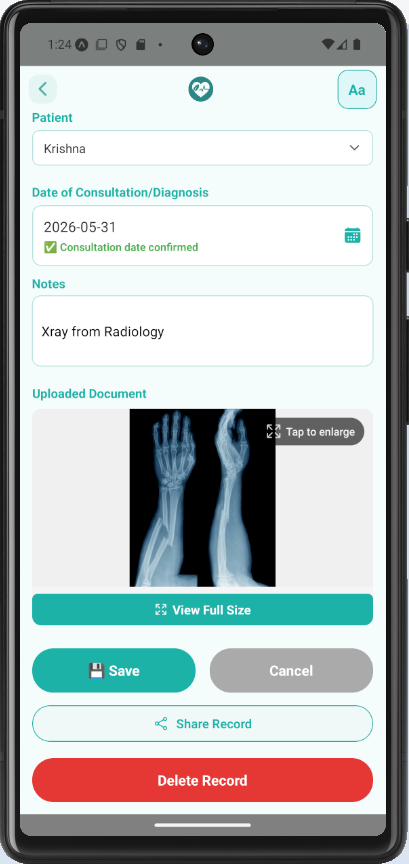 Reviewing an extracted X-ray record before saving